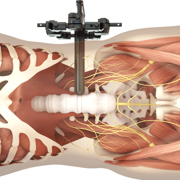 Spineart_portfolio_synthes3d_illustration_image_2